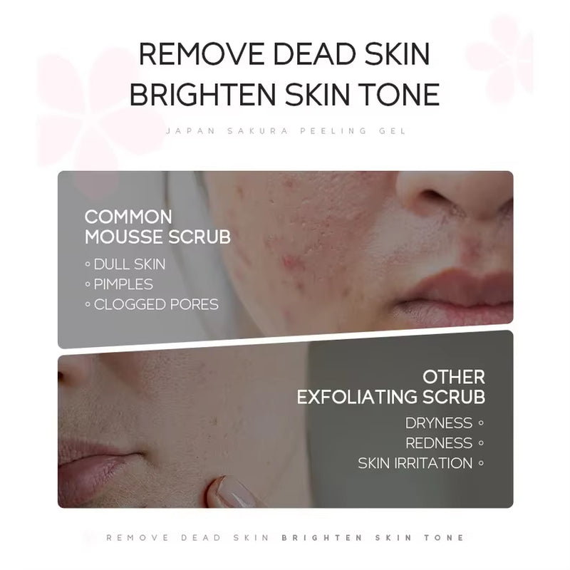 Sakura Peeling Gel Facial Exfoliation Cleans Pores Moisturizing Oil Control 60G