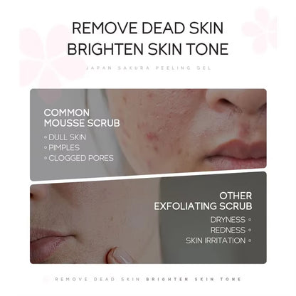 Sakura Peeling Gel Facial Exfoliation Cleans Pores Moisturizing Oil Control 60G